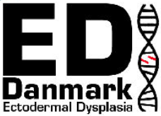 Ectodermal Dysplasia i Danmark